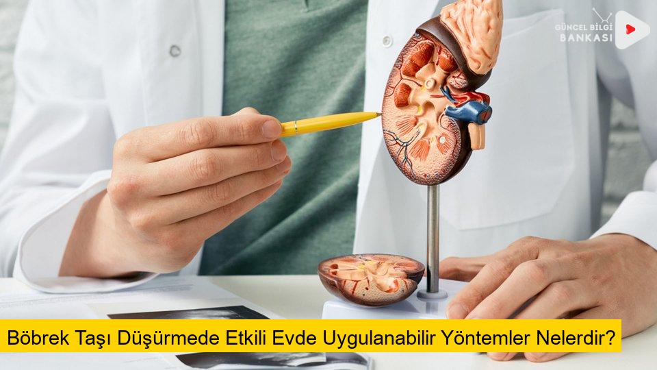 Böbrek Taşı Düşürmede Etkili Evde Uygulanabilir Yöntemler Nelerdir?