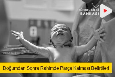 Doğumdan Sonra Rahimde Parça Kalması Belirtileri