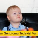 Down Sendromu Tedavisi Var mı?