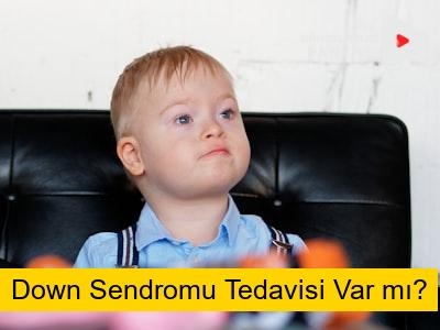 Down Sendromu Tedavisi Var mı?