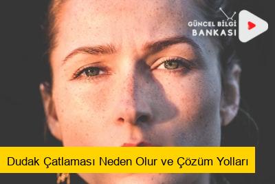 Dudak Çatlaması Neden Olur ve Çözüm Yolları