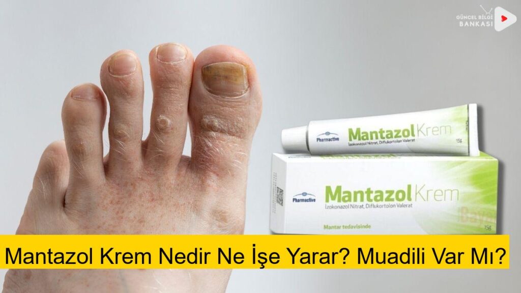 Mantazol Krem Nedir Ne İşe Yarar? Muadili Var Mı?